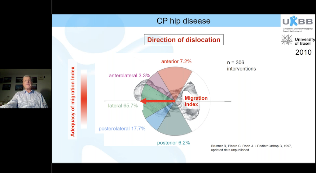 7th EPOS Webinar on Cerebral Palsy: CP Hip Disease: Surveillance and Treatment