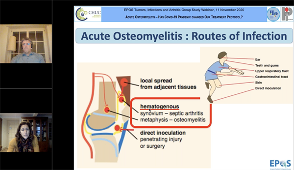 6th EPOS Webinar on Infection: Acute Osteomyelitis: Is Punction Always Required? Has COVID-19 Pandemic Changed our Treatment Protocol?