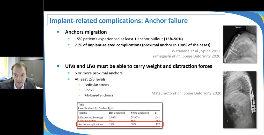 4th EPOS Webinar on Spine: Why and When Consider Surgery in Early Onset Scoliosis?