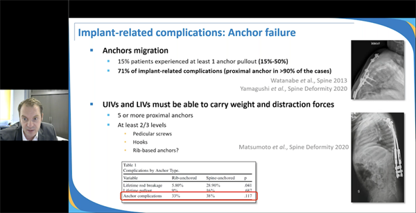 4th EPOS Webinar on Spine: Why and When Consider Surgery in Early Onset Scoliosis?