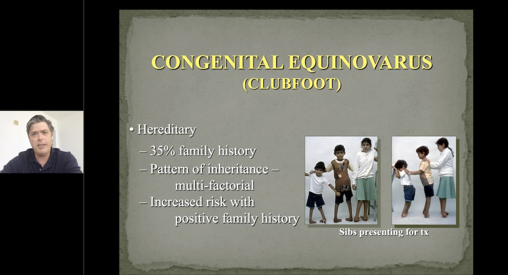3rd EPOS Webinar on Clubfoot: Clubfoot Treatment in 2020
