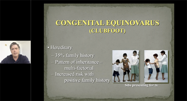 3rd EPOS Webinar on Clubfoot: Clubfoot Treatment in 2020