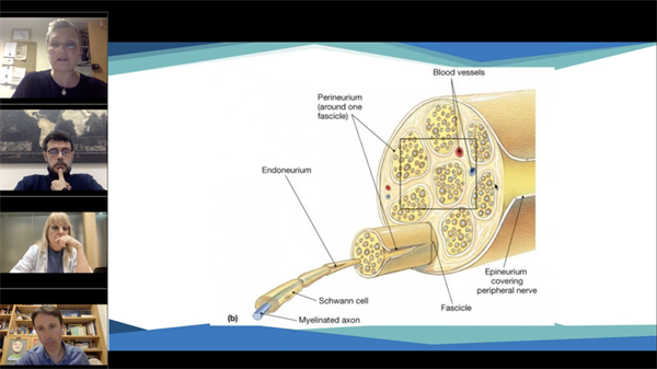 Nerve Injuries in the Upper Limb