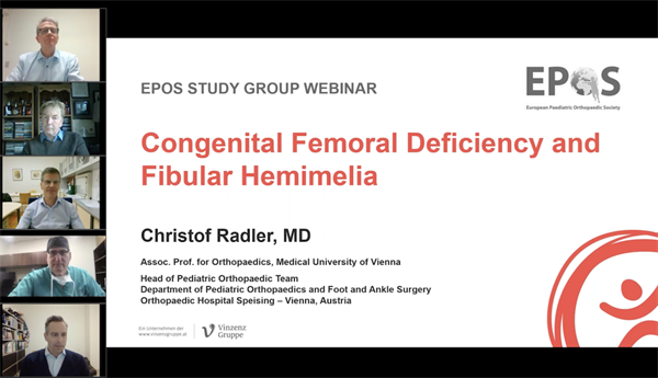 Congenital Femoral Deficiency and Fibular Hemimelia