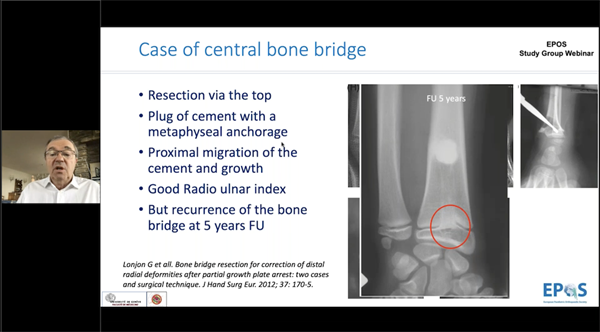 Physeal Injuries: Pathophysiology, Diagnosis and Principles of Management