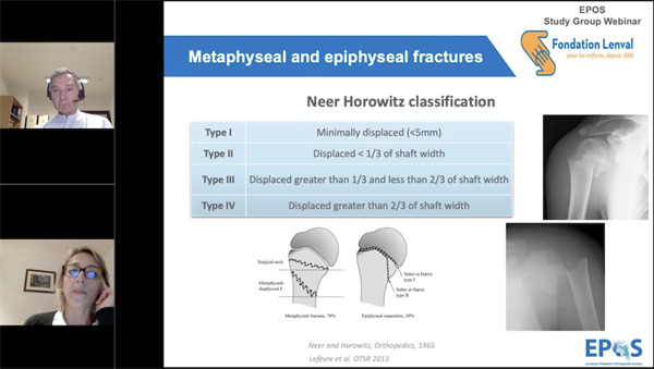 Controversies in Paediatric Upper Limb Trauma