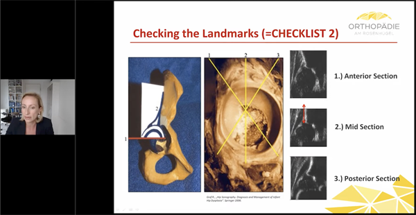 Current Standards in DDH Screening