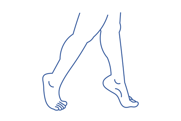 Toe Walking