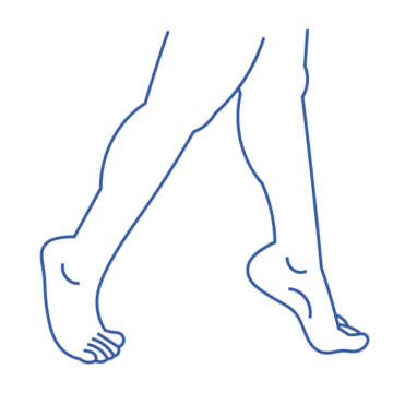 Toe Walking