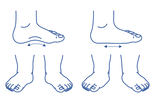 Flat Feet