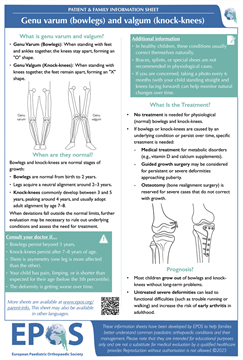 Genu varum (bowlegs) and valgum (knock-knees)