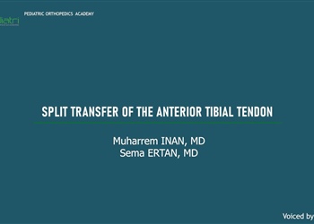 Split Transfer of the Anterior Tibial Tendon