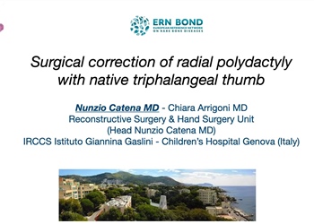 Surgical Correction of radial polydactyly